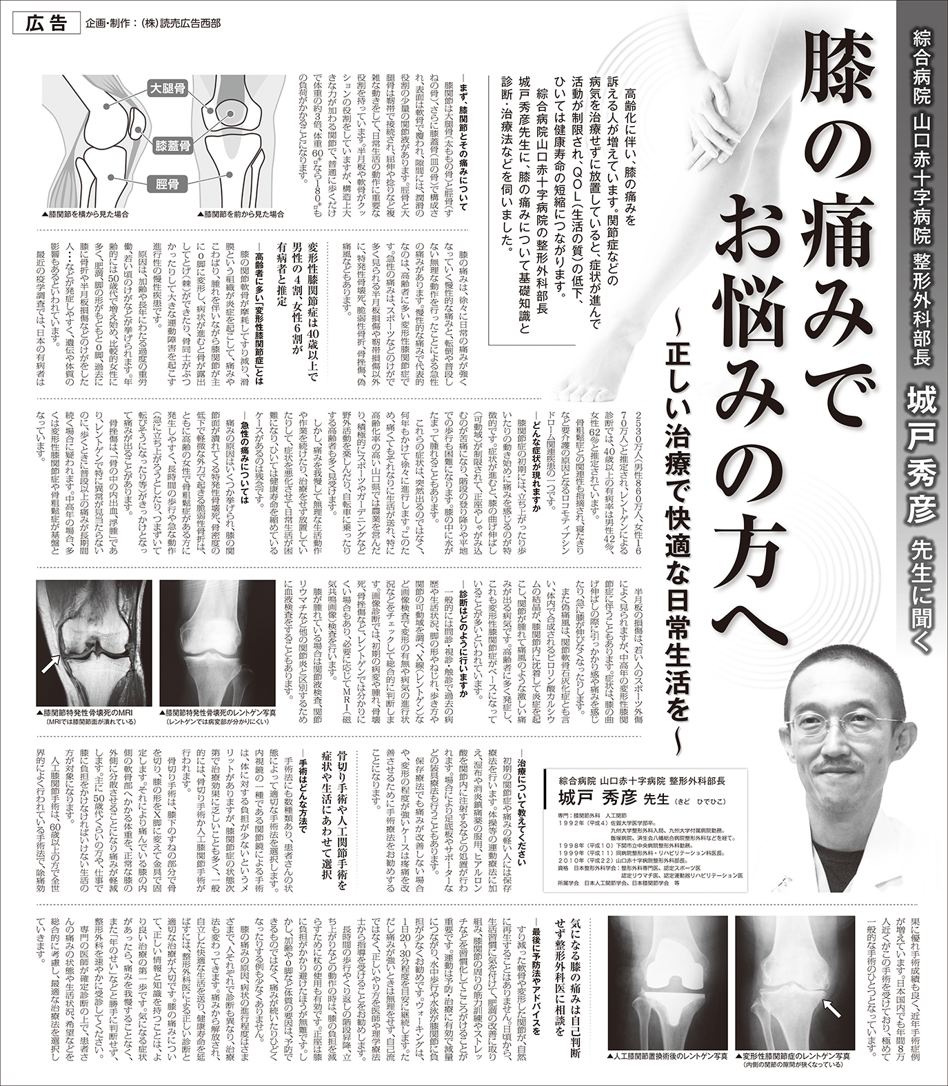 城戸院長のインタビュー記事紹介「膝の痛みでお悩みの方へ」(読売新聞／2015年8月掲載）