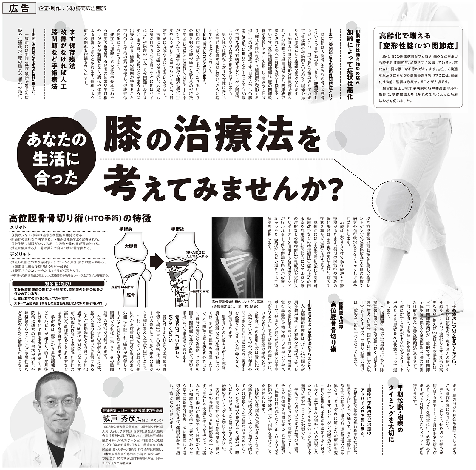城戸院長のインタビュー記事紹介「あなたの生活に合った膝の治療法を考えてみませんか？」(読売新聞／2019年7月掲載）