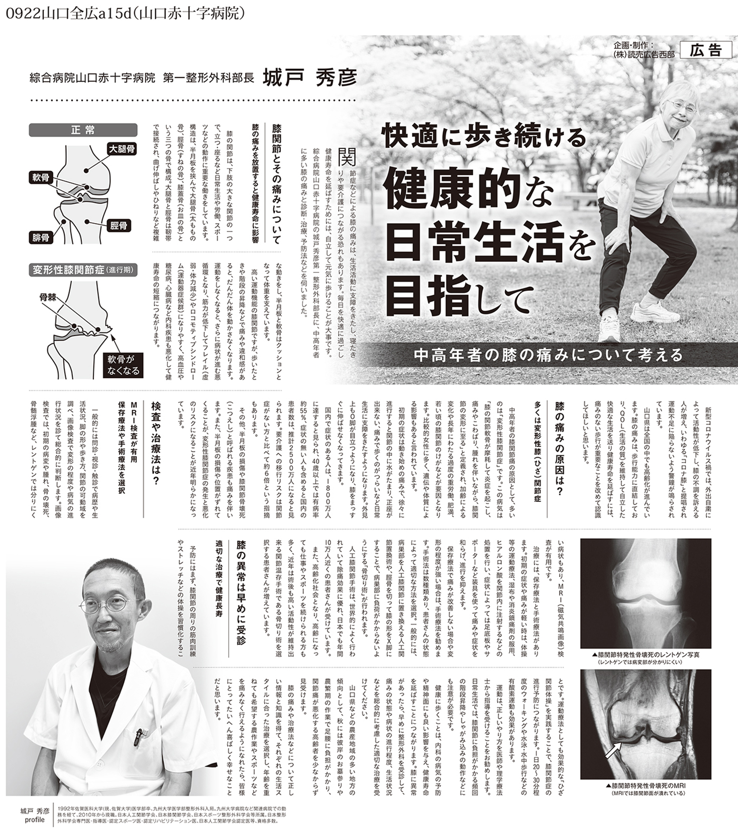 城戸院長のインタビュー記事紹介「快適に歩き続ける健康的な日常生活を目指して」(読売新聞／2023年9月掲載）